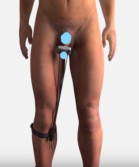 A device for increasing a member