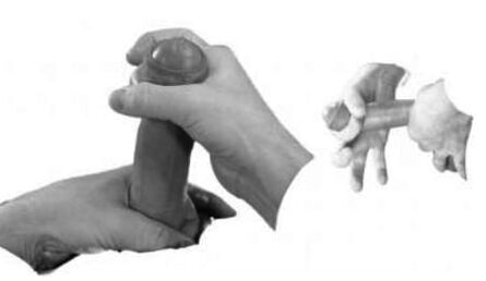 Sprain of the penis to increase it